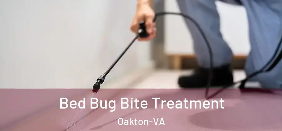  Bed Bug Bite Treatment Oakton-VA